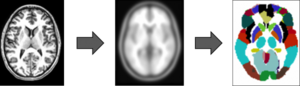 Photograph of three brains on a horizontal plane