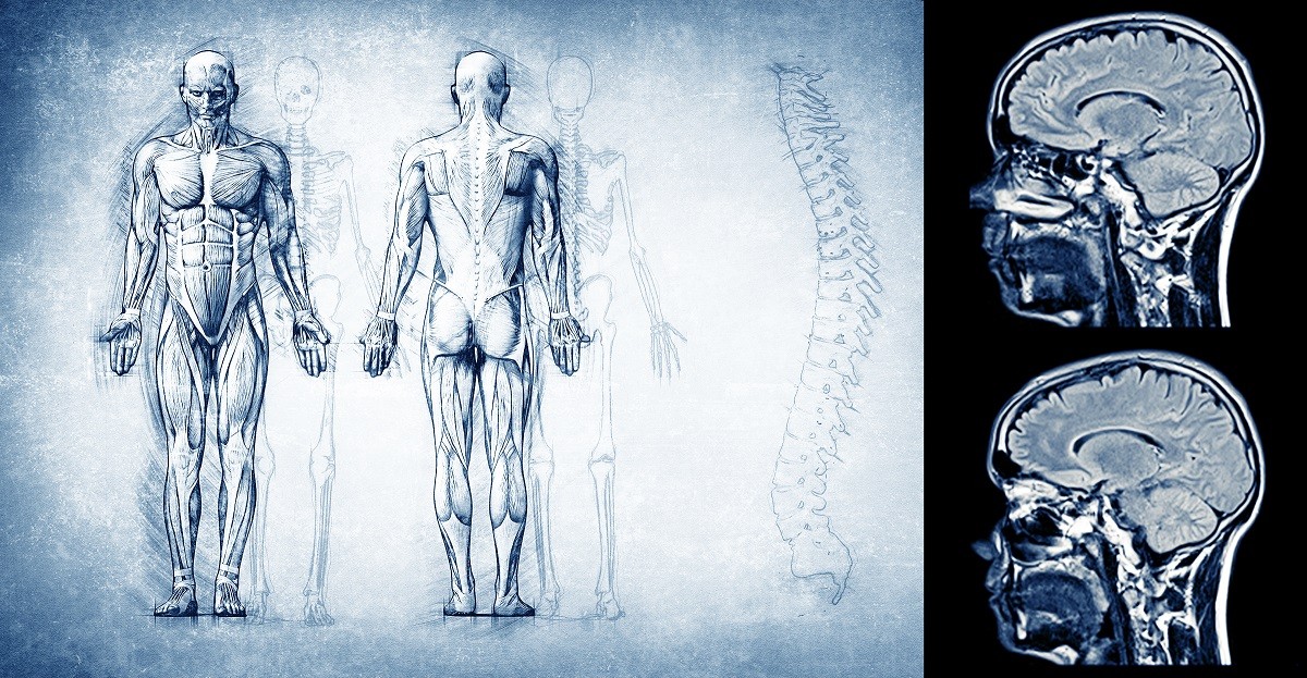 Chronic pain, anatomical drawing of a man, spine, and human MRI images