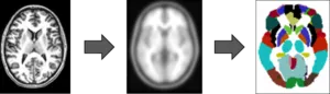 Photograph of three brains on a horizontal plane